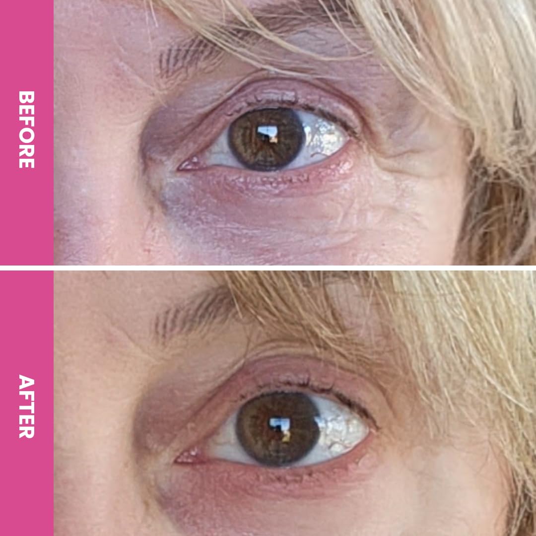 PrimeEyes Hydrate Under Eye Cream for Mature Women – Hydrating Eye Cream for Dark Circles and Wrinkle Repair – Soft, Glowing & Healthy Under Eyes