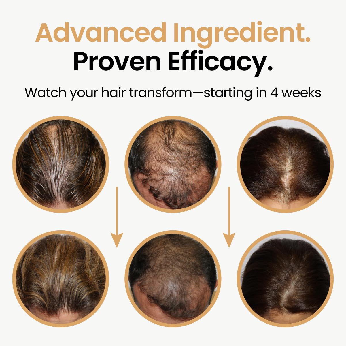 Hair Booster for Women & Men – Hair Revitalizing Serum with Capilia Longa & Arginine for Thick, Dry, Long, Damaged Hair – Peptide-Enriched Hair Tonic, 2 Fl Oz - Pack of 3