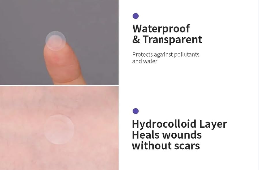 a.l.m. Magical Patch (3) Hydrocolloid pimple patches. These ultra thin & translucent hydrocolloid adhesive covers and absorb unwanted pimples. Parches Para Acne for skincare.