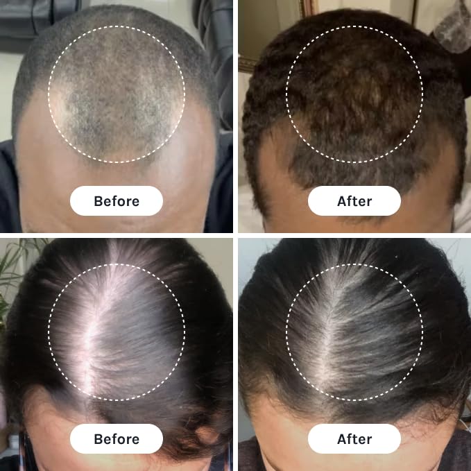 InfiniWell PTD-DBM Peptide Hair Serum for Fuller-Looking Hair - Scalp Treatment for Visible Growth & Follicle Renewal - Reinforce Restoration, Strand Integrity & Optimal Density (25 ml)