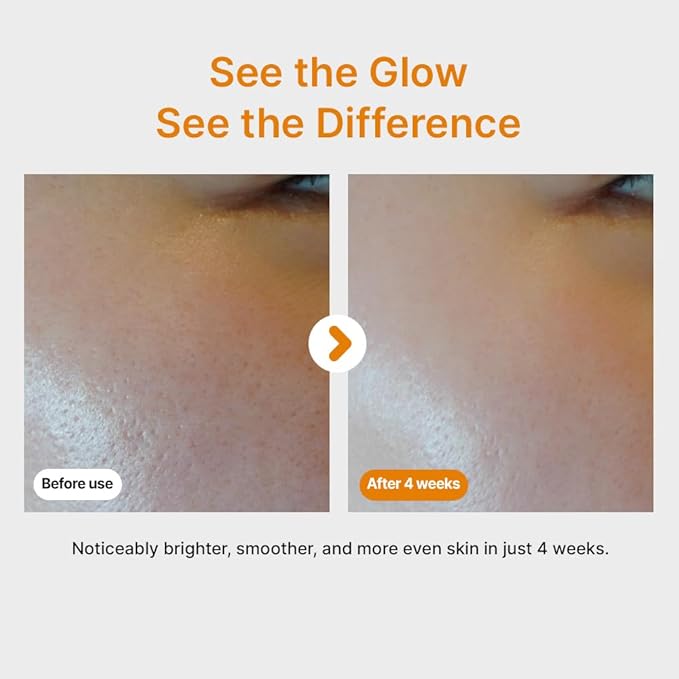 Pure Vitamin C Serum - Best Korean Skincare with Vitamin 10.5%, No Added Water, Special Airless Pump, Brightening and Firming Skin, Improving Uneven and Dull Skin Tone, 30ml/1.01fl.oz.