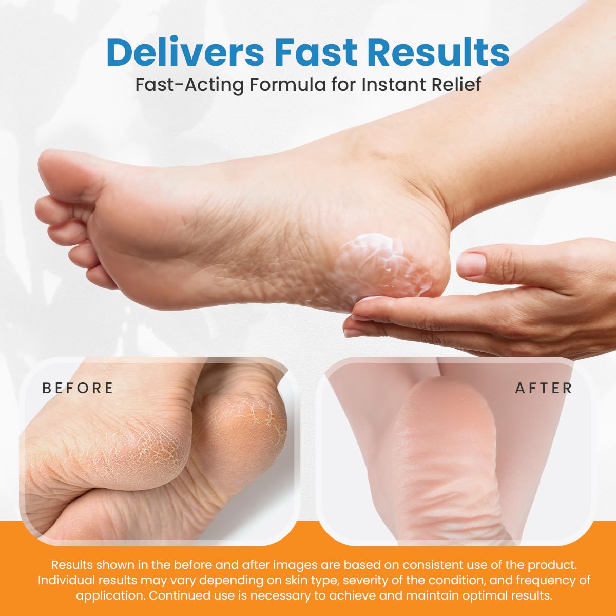 Revitaderm 4D Urea Cream 40% for Feet, Intensive Moisturizing Foot Cream for Dry, Rough, Callused Skin, Includes Free Pumice Stone and Exfoliating Brush, Fast-Absorbing, Fragrance-Free, 4oz, 3 Pack
