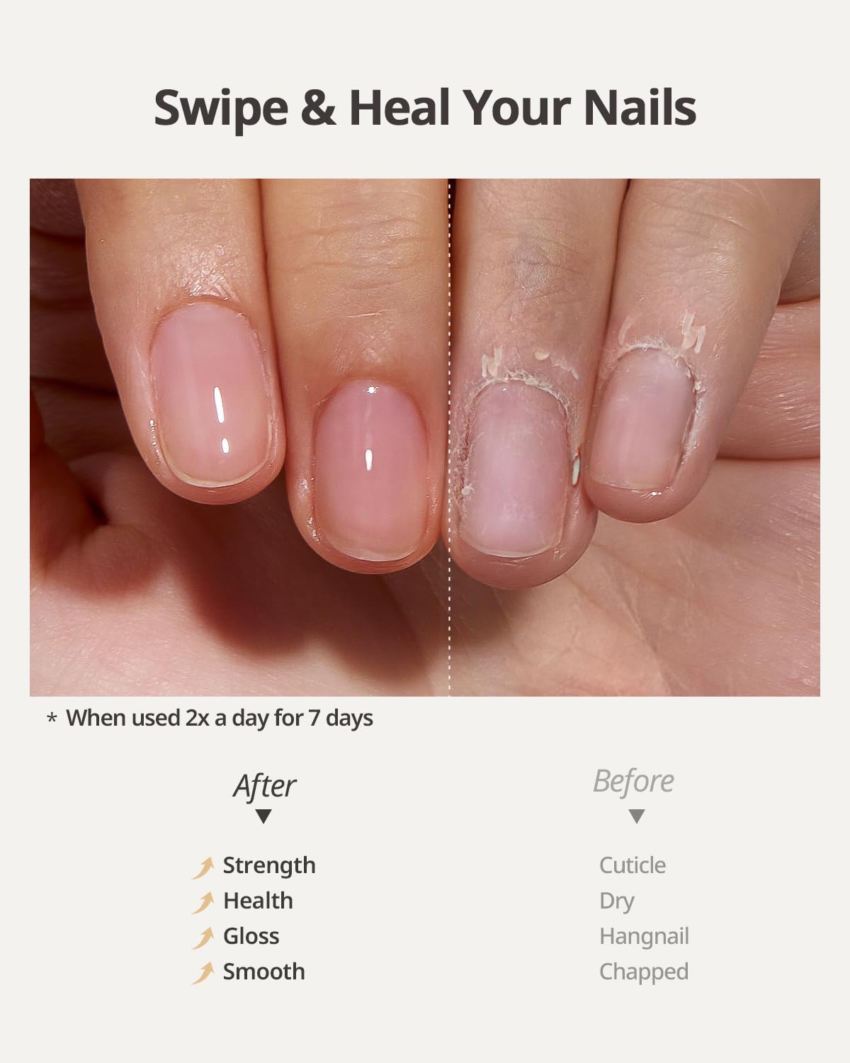 BTARTBOXNAILS Cuticle Oil - Essential Cuticle Oil to Moisturize & Condition with Jojobal Oil, Vitamin E, Biotin, Squalane, Oil-Water Dual Phase Nourishing Treatment for Daily Cuticle Care, 15ml