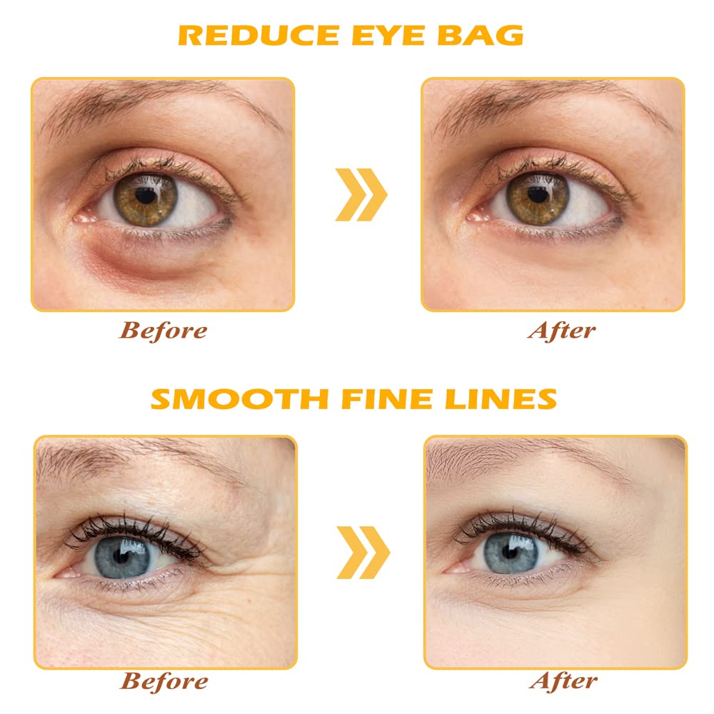 24K Gold Eye Mask, 30 Pairs Under Eye Masks for Dark Circles and Puffiness Treatment, Under Eye Patches for Puffy Eyes and Eye Bags, Gel Eye Mask Eye Pads for Face Skin Care