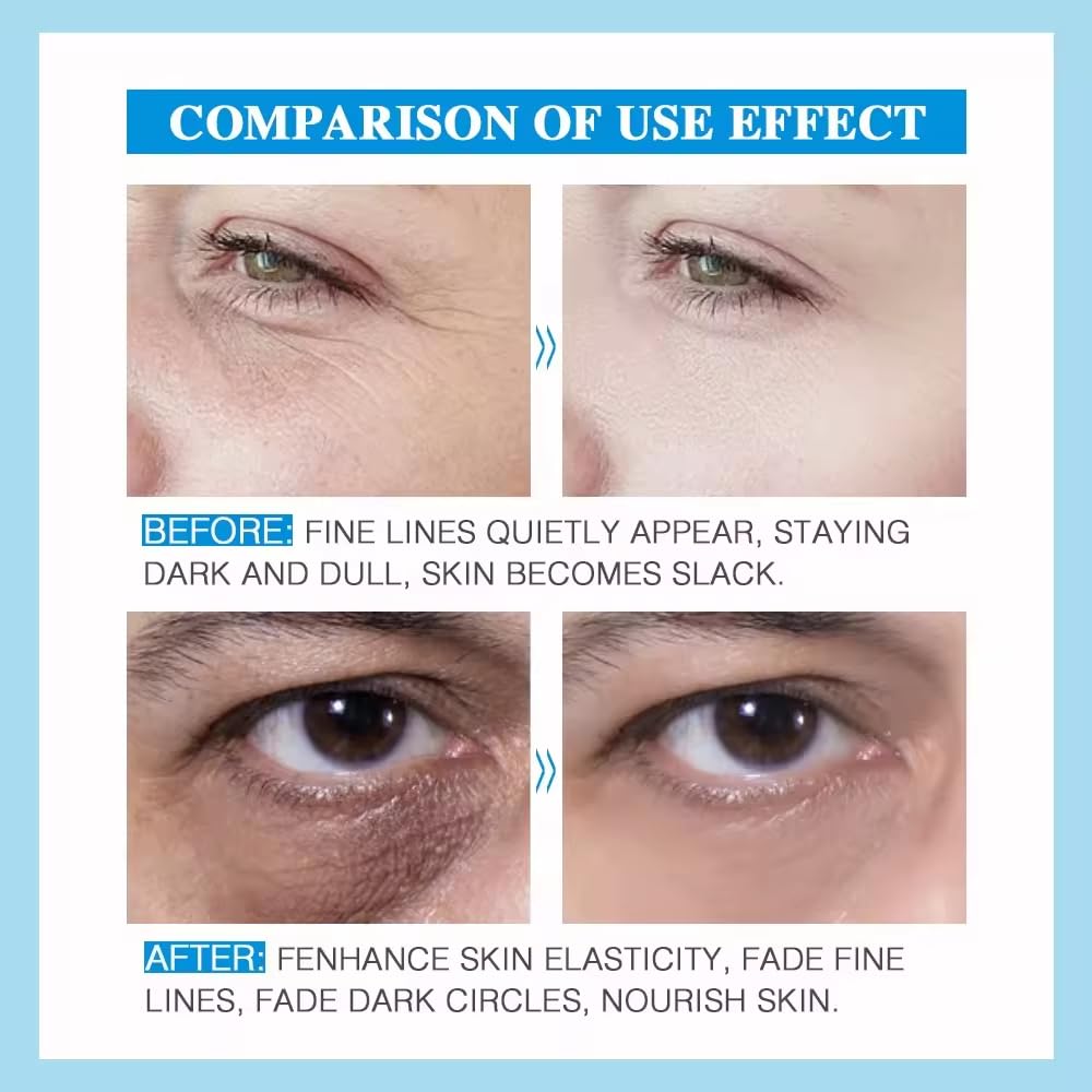 Miracle Instant Eye Lift Eye Cream Anti-Wrinkle
