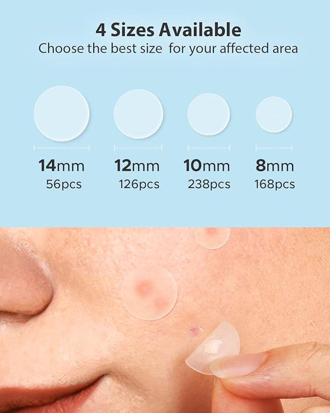 LitBear Acne Pimple Patches- Day and Night 4 Sizes 588 Dots Thin & Thick Hydrocolloid Patches with Witch Hazel, Tea Tree & Calendula Oil, Extra Adhesion for Face Zit Patch Dots