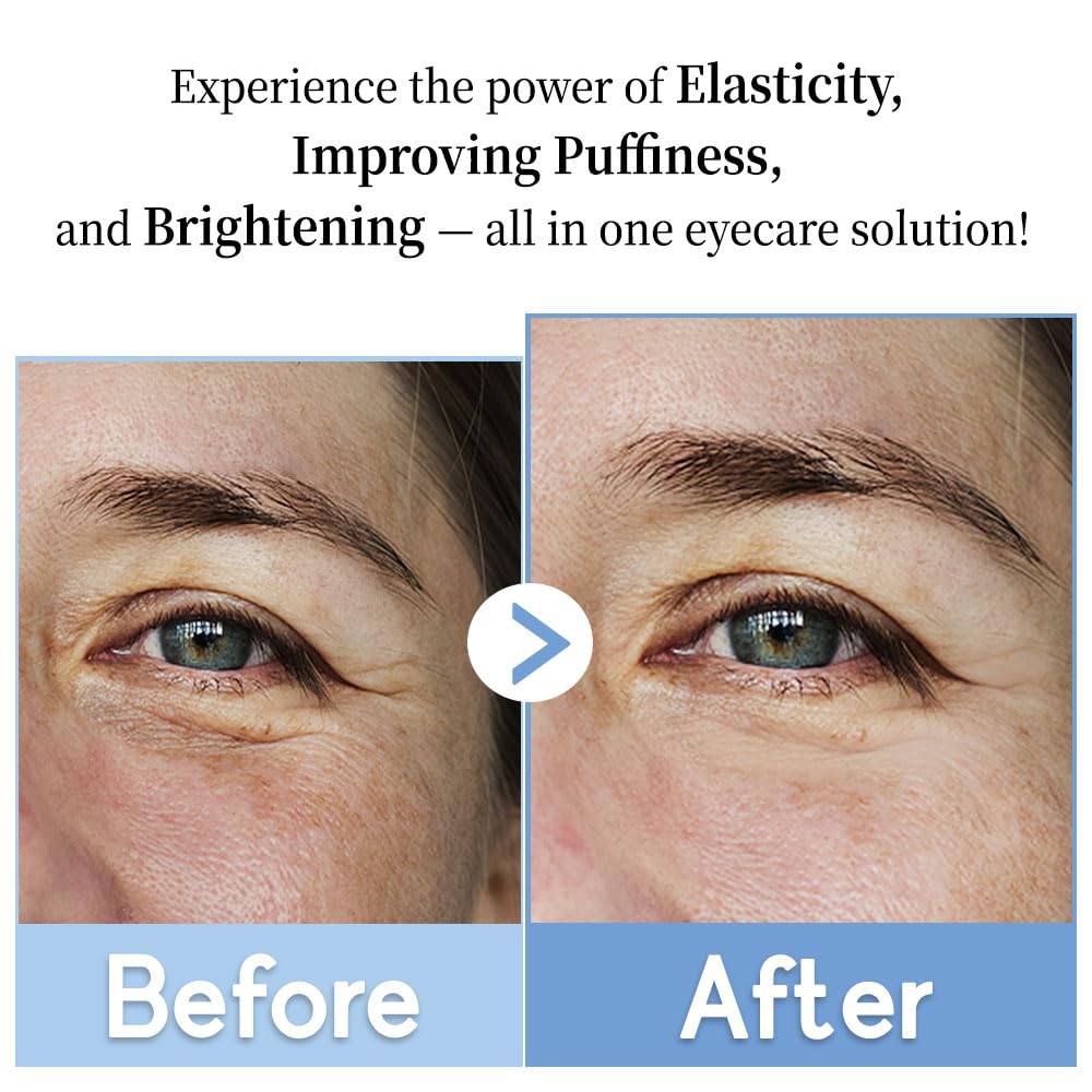 Purederm Revitalizing Eye Gel Serum – Cooling Eye Roller with 5% Volufiline, Caffeine & Vegan Collagen – Reduce Puffiness, Fine Lines & Dark Circles – For All Skin Types – 0.88 oz