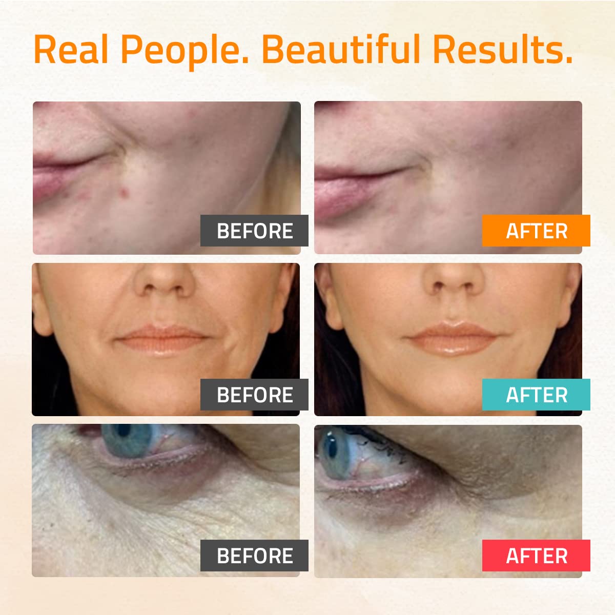 YEOUTH Retinol Serum for Face, Vitamin C Serum for Face with Hyaluronic Acid Serum for Face, Retinol for Face Serum, Vitamin C Face Serum for Women, Skin Care Set 3x1 oz