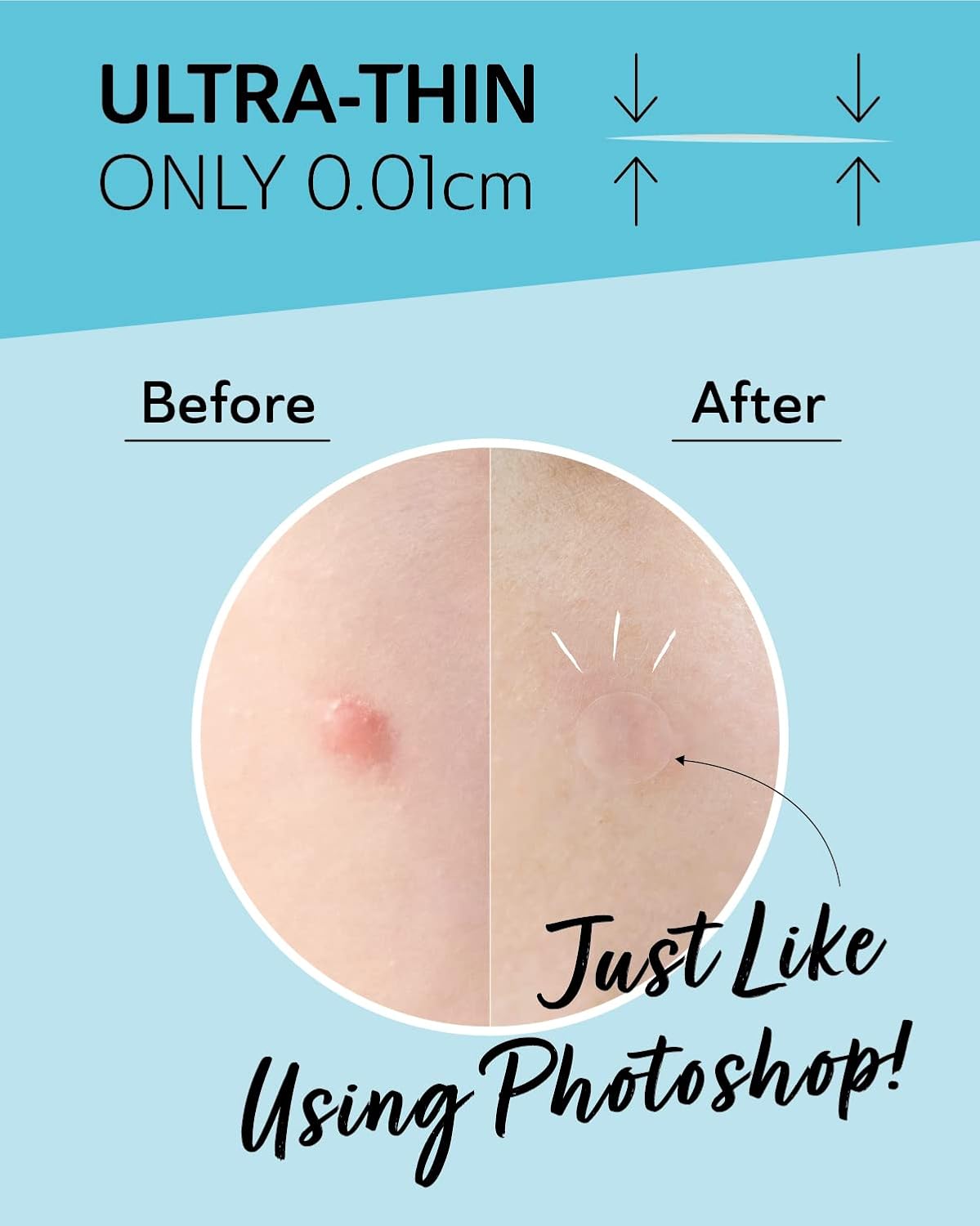 Invisible Salicylic Acid Pimple Patches for Face - Redness Reducing Hydrocolloid Acne Patches, Clear Pimple & Zit Patches for Blind Pimples - Soothing Plus (Clear Patch) (Intensive-36dots-2)