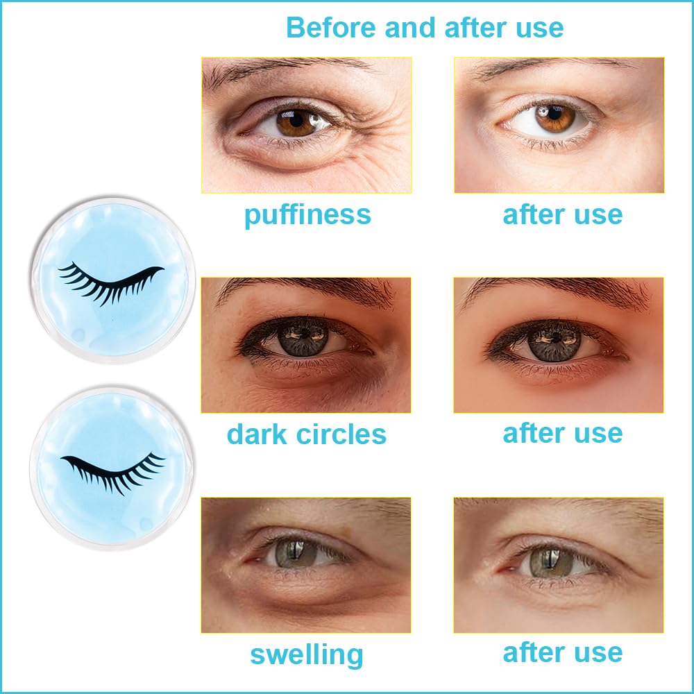 Face Eye Masks for Dark Circles and Puffiness, Migraines, Headache, Stress, Redness, Acne, Cooling Face Masks for Women Man, Hot Cold Use Ice Face Mask. (Blue set)