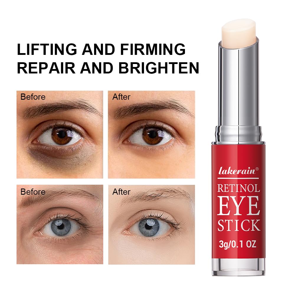 Retinol Eye Stick-Peace Out Dark Circles with this Anti-Aging Eye Cream and Brightening Balm Visible in 3-4 Weeks Reduces Fine Lines and Puffiness, Banishes Wrinkles and Dark Circles under Eye