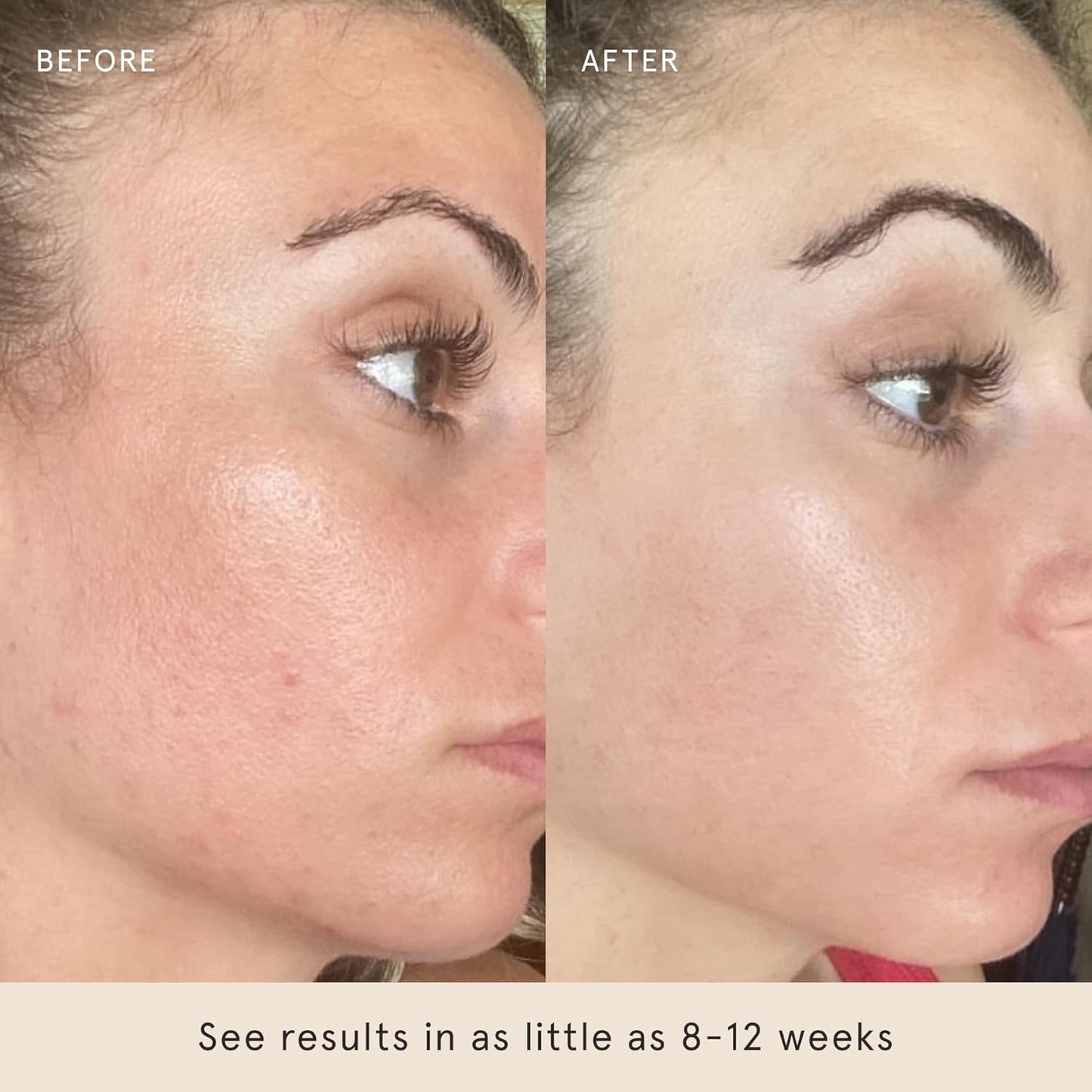 Barefaced Toning Pads (60 count) - Exfoliating Face Pads with 2% Glycolic Acid & Salicylic Acid - Brightens & Cleanses Skin, Clears Pores, Reduces Fine Lines & Wrinkles