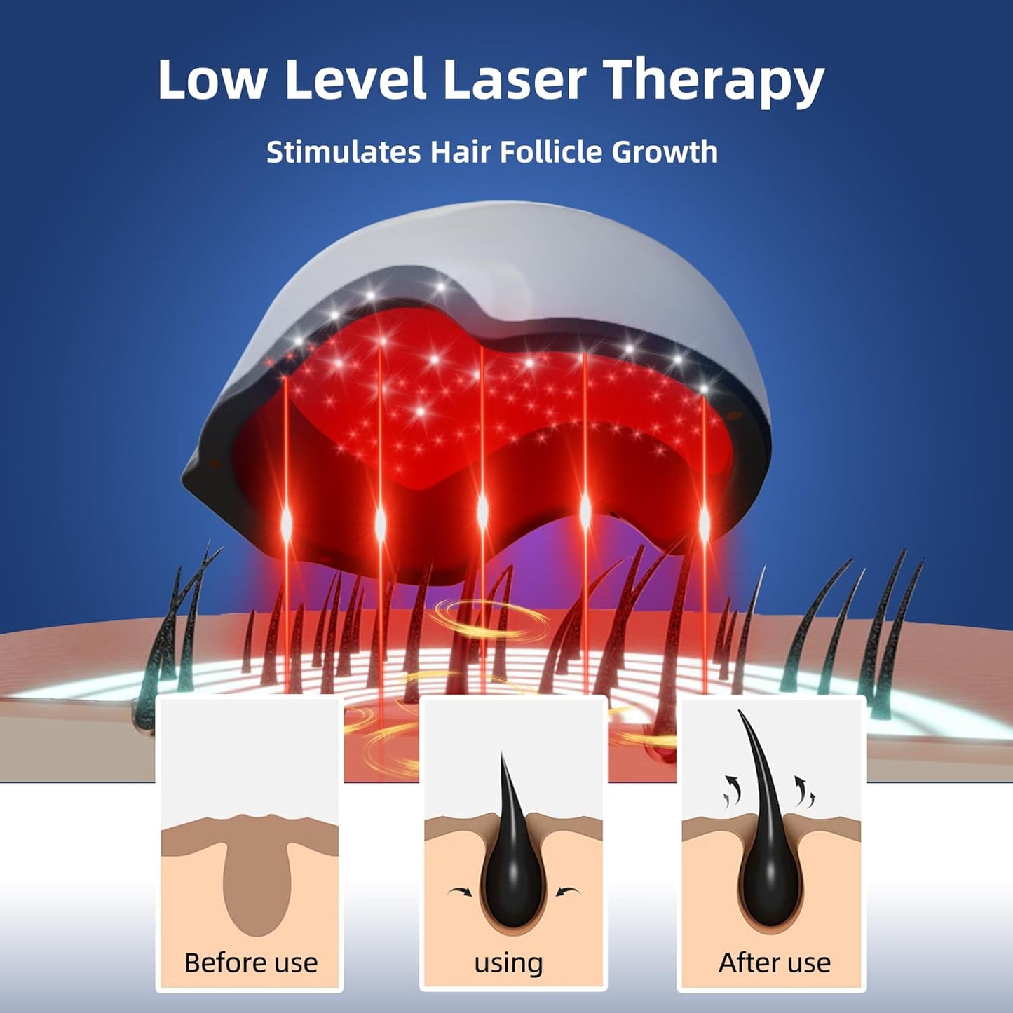 Laser Red Light Therapy for Hair Growth Device, FDA Cleared Hair Loss, Hair Growth Device