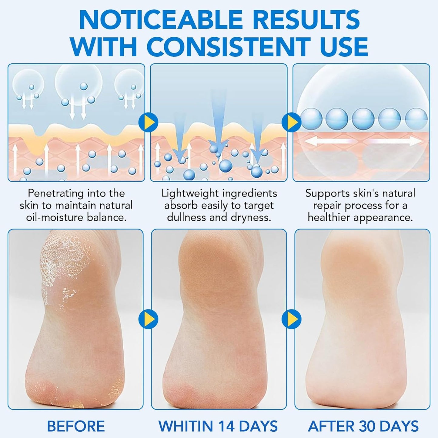 Urea Foot Care Stick, 2pcs 60% Urea with 2% Salicylic Acid Foot Cream Moisturizer for Dry Cracked Feet, Knees, Elbows, Hands, Moisturizes and Hydrates the Dry Skin, Callus Remover & Skin Softener