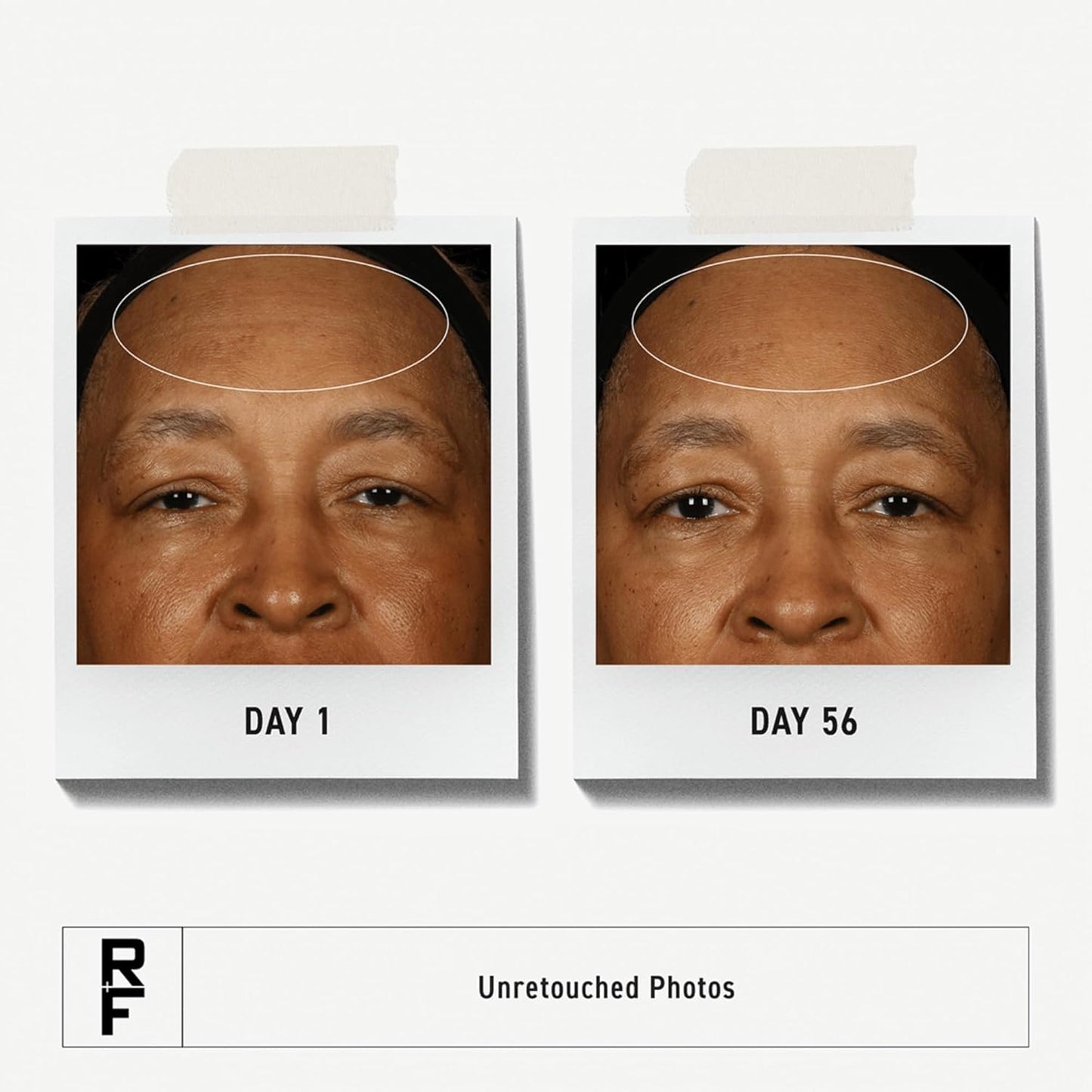 Rodan + Fields Redefine Pore Minimizing Toner | 4.2 fl oz | Deep Exfoliating Cleanser | Visibly Reduces Blackheads | Formulated with Fruit Acids