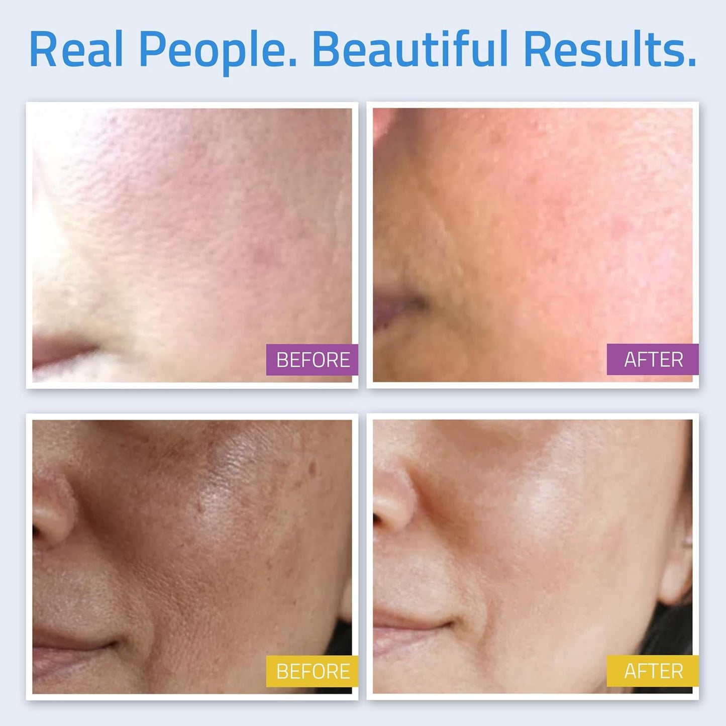 YEOUTH Skin Care Set: Retinol Serum for Face with Hyaluronic Acid, Vitamin C Serum, Face Serum, Cleanser, Toner, Eye Gel, Neck Cream, Face Cream, Gifts for Women & Men, Self Care Routine 8-Piece