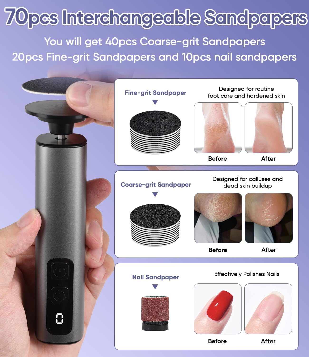 Electric Foot Callus Remover - 9 Speed Callus Remover for Feet with USB Rechargeable,Electric Foot File Pedicure Tools for Feet Dead Skin Heel Callus Hardskin Dry Cracks for Women Men (Dark Gray)