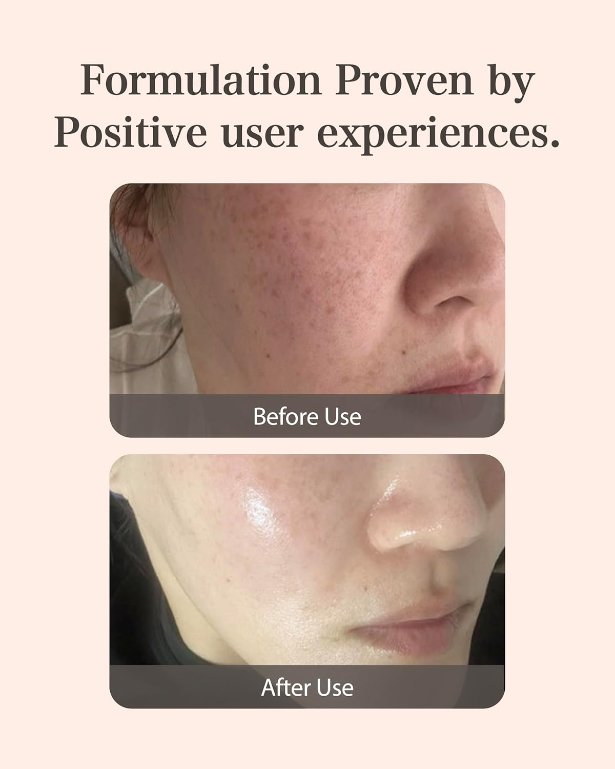 MASTINA Mastic Ampoule Serum Spoid Type Set(Dropper Type, 0.5fl oz, pack of 3), Fermented Mastic Gum. White Mastic Complex 63% + Tranexamic Acid 2% + Niacinamide 5%