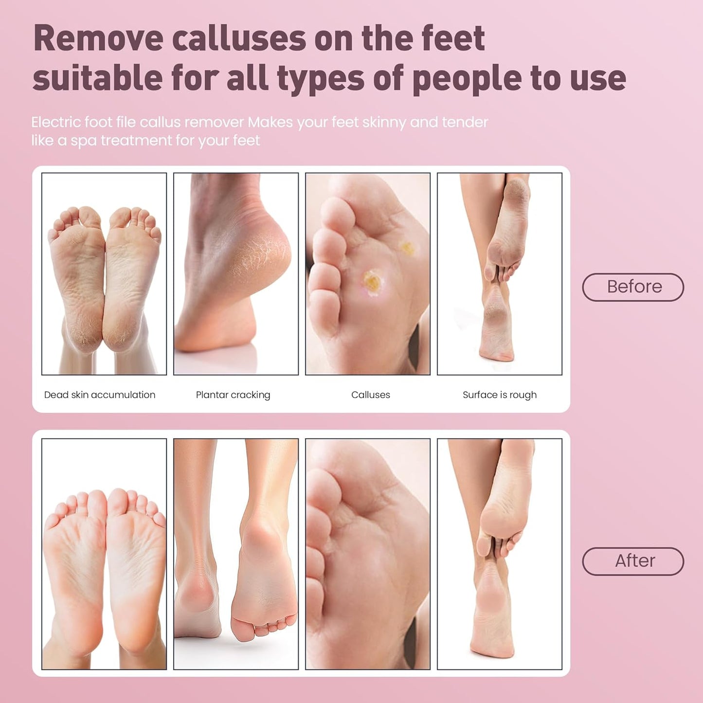 Electric Foot Callus Remover,2 in1 Rechargeable Callus Remover for Feet,9-Speed Wireless Electric Foot File Nail Grinder,Foot Scrubber Pedicure Tools for Dead Skin Dry Cracked Feet(Pink MINI)