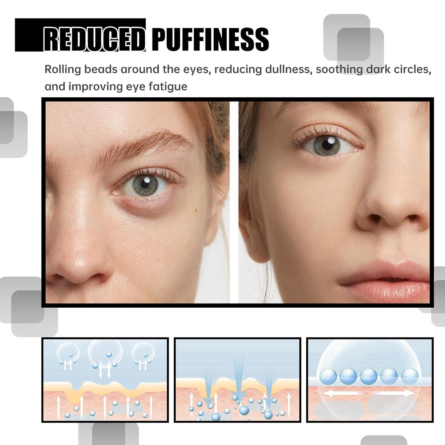 Time Eraser Roller Ball Castor Oil, Castor Oil Frankincense Rollerball, Time Eraser Rollerball for Eyes, Bags Under Eyes, Rollerball Castor Oil (2PCS)