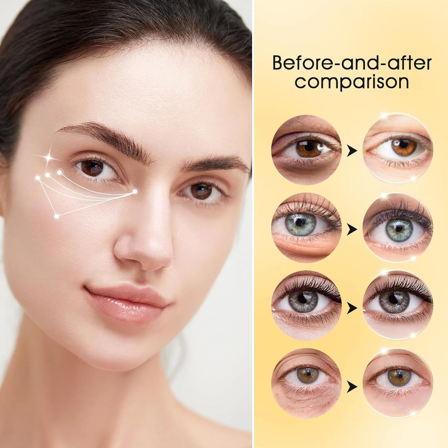 Adofect 30 Paris Under Eye Patches 24k Gold Under Eye Mask for Puffy Eyes and Dark Circles Treatments, Under Eye Bags Treatment Collagen Gel Pads for Beauty & Personal Care, Gold