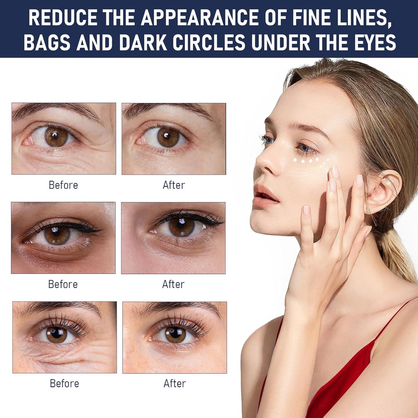 Rapid Reduction Eye Serum, Advanced Formula Instant Eye Serum, Anti Aging Serum Visibly Reduces Under-eye Bags, Nourishing Eye Serum, Suitable For All Skin Type (2Pcs)