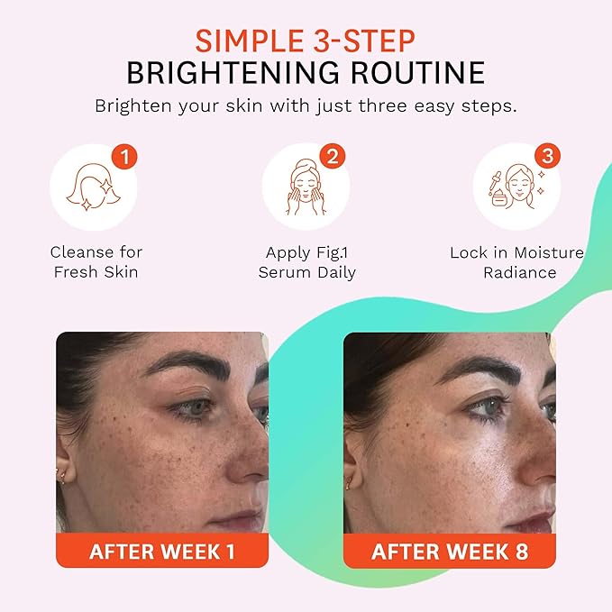 Fig.1 Even Tone Serum for Dark Spots & Uneven Skin Tone, Glowing Skin Face Serum with Niacinamide, Azelaic Acid, Tranexamic Acid & Alpha-Arbutin, Fragrance-Free, Safe for Sensitive Skin, 30ml