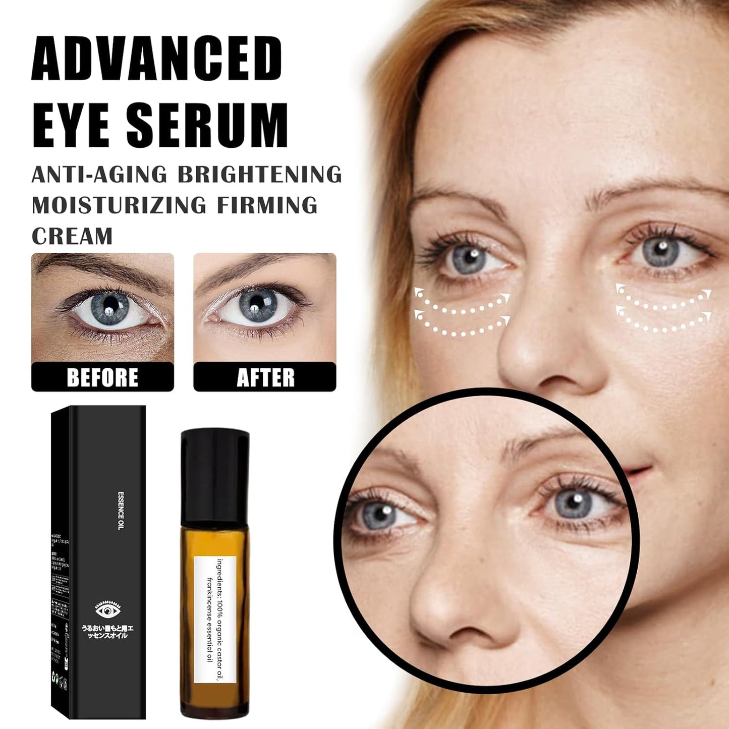 Time Eraser Roller Ball Castor Oil, Castor Oil Frankincense Rollerball, Time Eraser Rollerball for Eyes, Bags Under Eyes, Rollerball Castor Oil (2PCS)