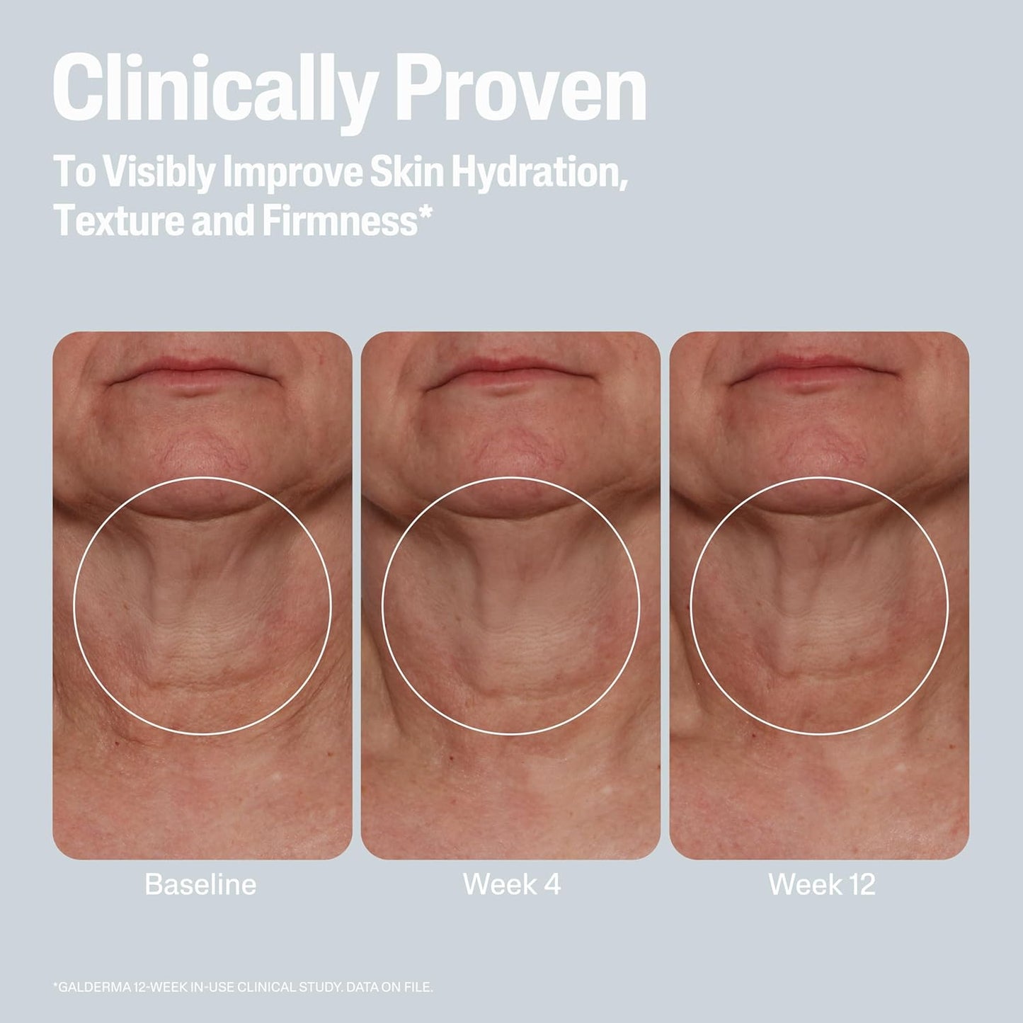 Cetaphil Skin Activator Hydrating & Firming Body Cream 12oz, Mandelic Acid (AHA) and Centella Asiatica (CICA) Cream, Hydrates and Firms Aging Skin, Anti-Aging Skin Care, 12 oz