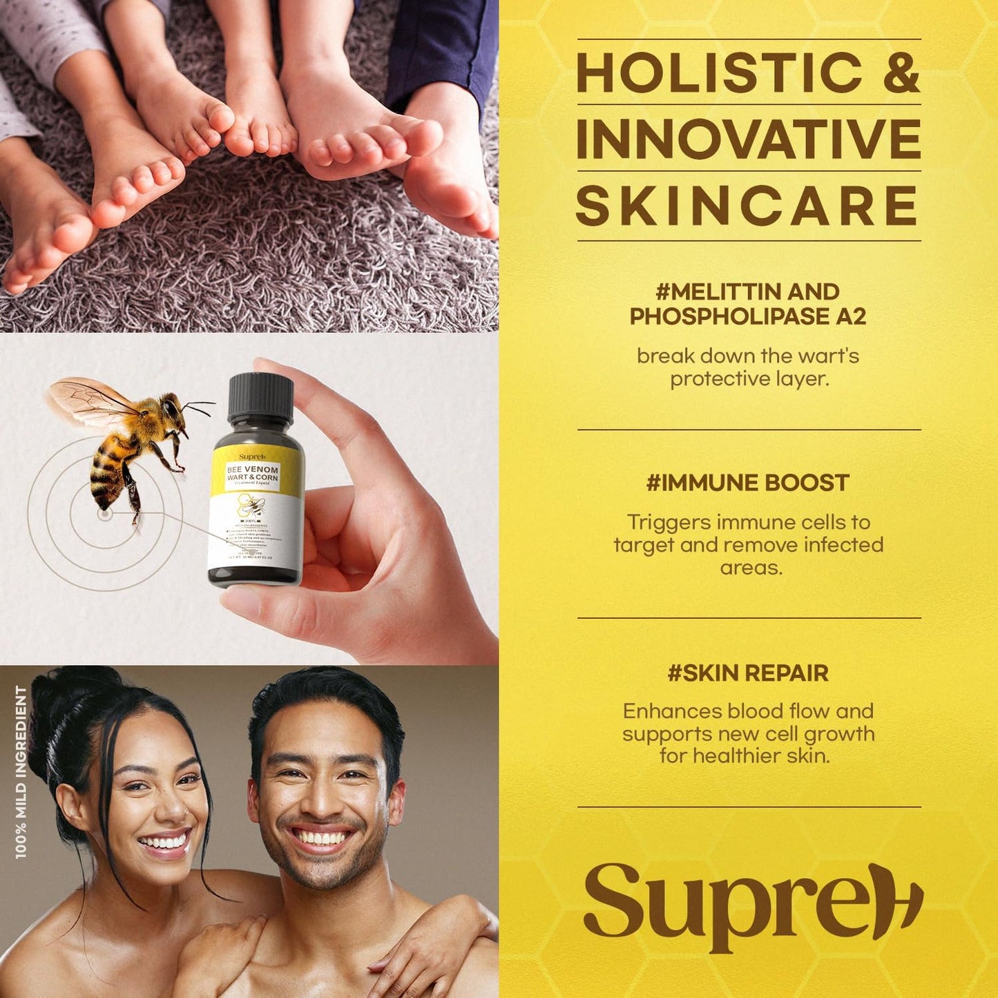 Fast-Acting bee Venom wart Remover: wart Freeze Off with salicylic Acid & bee Venom Cream - Wart Removal for Plantar Wart Genital Wart 18 ML