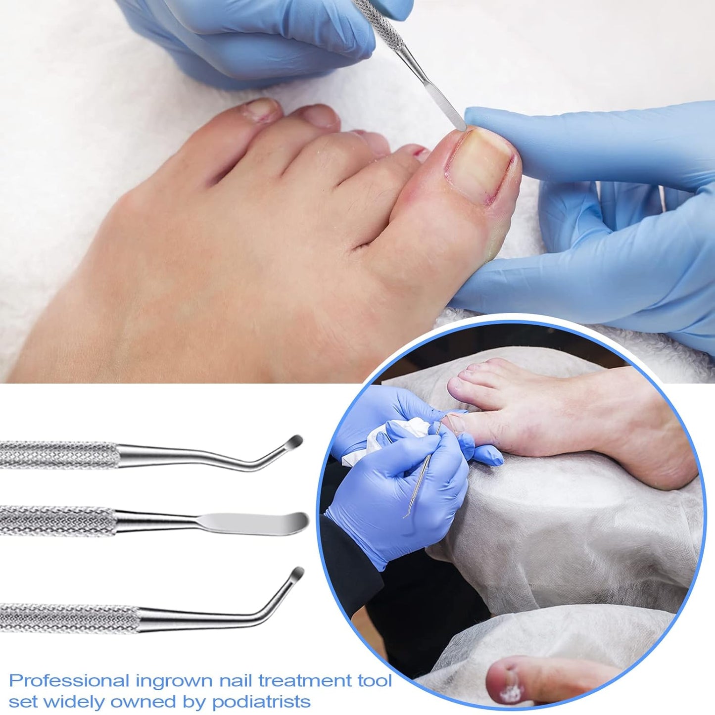 Ingrown Toenail Tool Removal Tool Kit, 10PCS Surgical Stainless Steel Professional Ingrown Toenail File and Lifters Manicure Care Treatment for Nail Correction Under Sidewall Clean