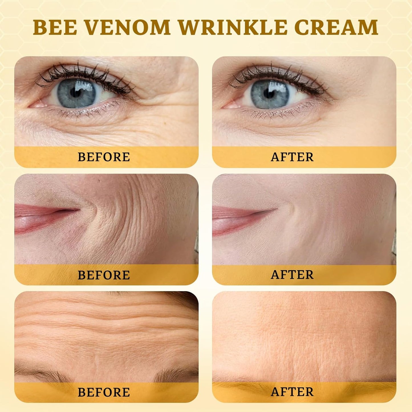 2PCS Bee Venom Comprehensive Cream: Wrinkle Care Face Lift & Firming, Effective In Reducing Skin Blemishes, Natural Care and Non-Irritating, Bee Venom Joint Cream for All Body Parts, 60g * 2PCS