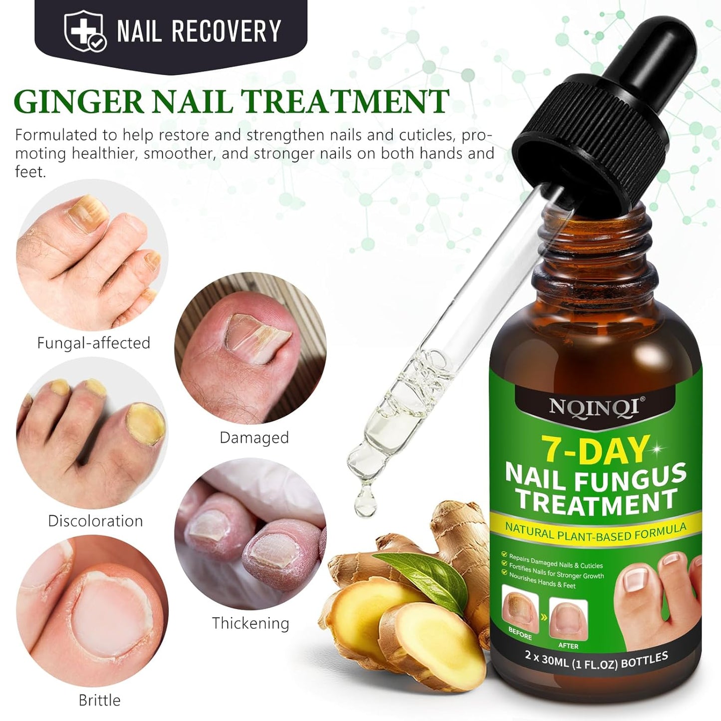 Nail Treatment, 7 Days Nail Treatment Extra Strength, Nail Liquid Maximum Strength - Ginger Nail Treatment Serum for Strengthen & Promote Nail Growth with Natural Plant Formula- 2PCS
