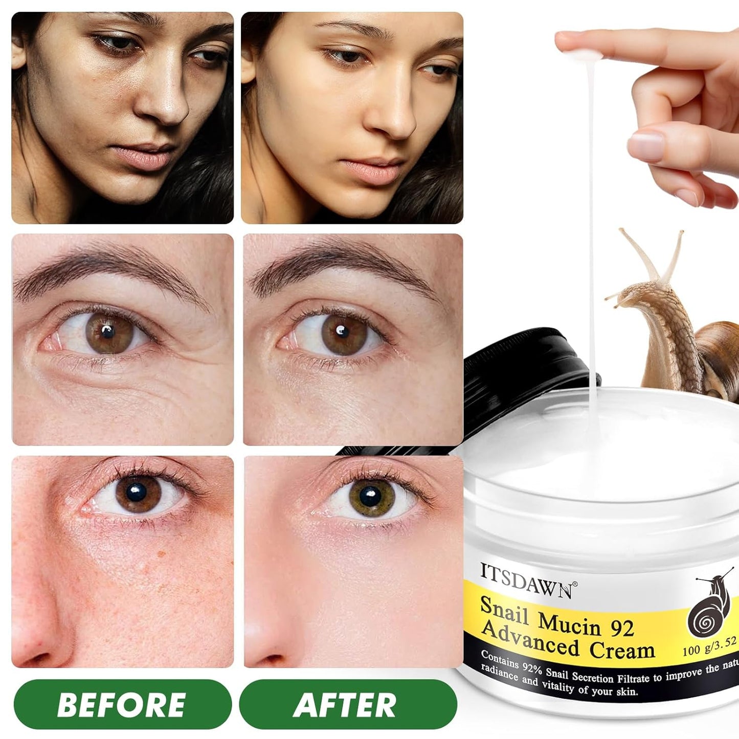 Snail Mucin 92% Repair Cream 100g, Face Moisturizer Hydrating Repair Face Cream for Dry & Sensitive Skin, All Skin Types