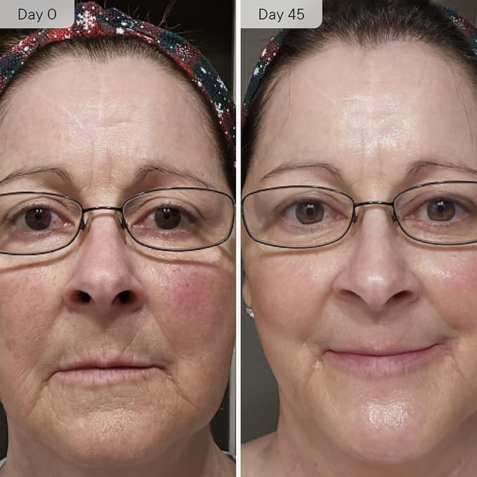 Qure Micro Infusion System for Face & Neck - Facial Moisturizing Essence, Hydrating Serum for All Skin Types, Refreshed Skin - 1-Month Supply