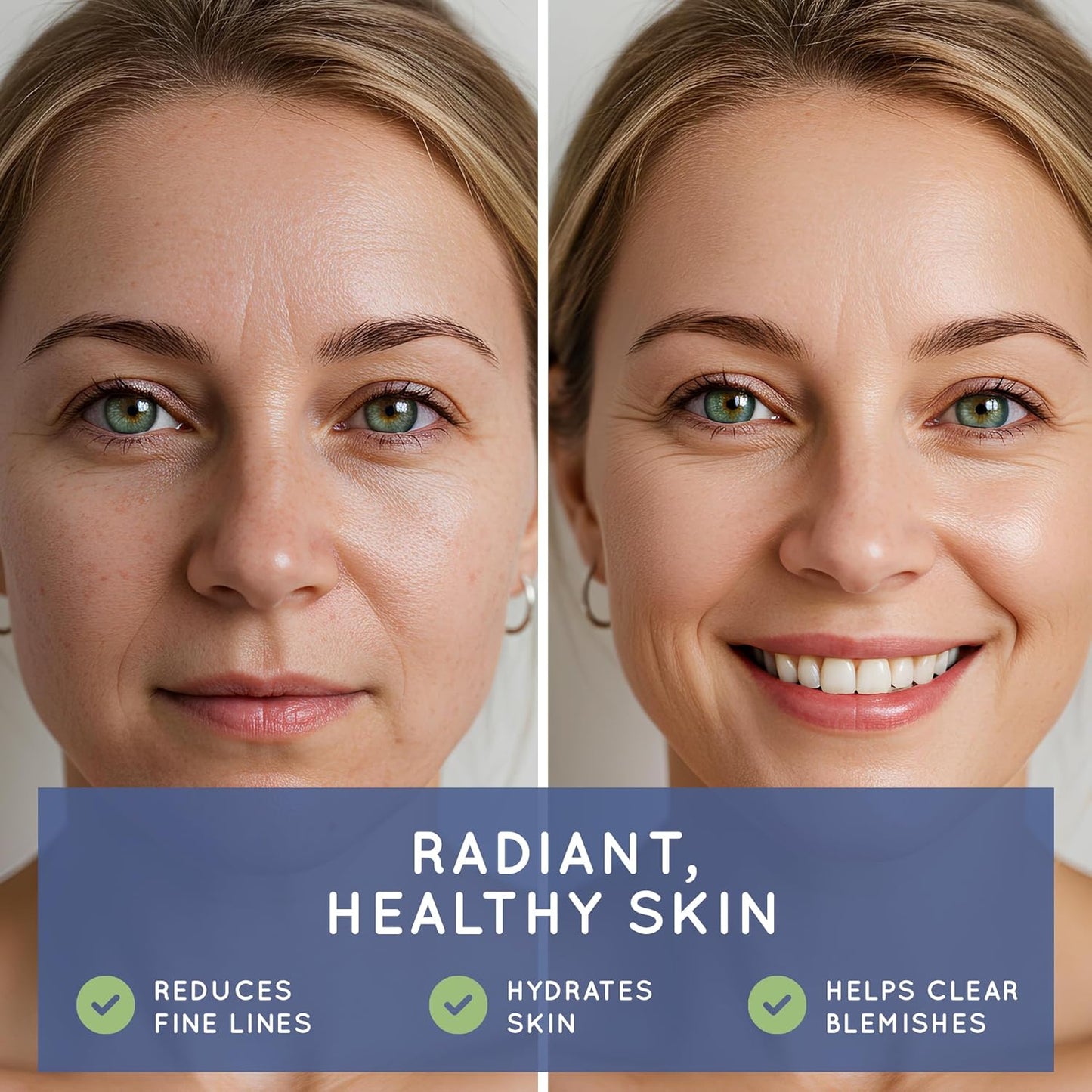 Biotin (Biotina Vitaminas) - Hair Skin Nails Vitamins for Women & Men - 5000 mcg - Hair Growth Support Supplements - 30 Tablets - with Revytalyz 5, Vitamin A, C, B12 - Made in USA