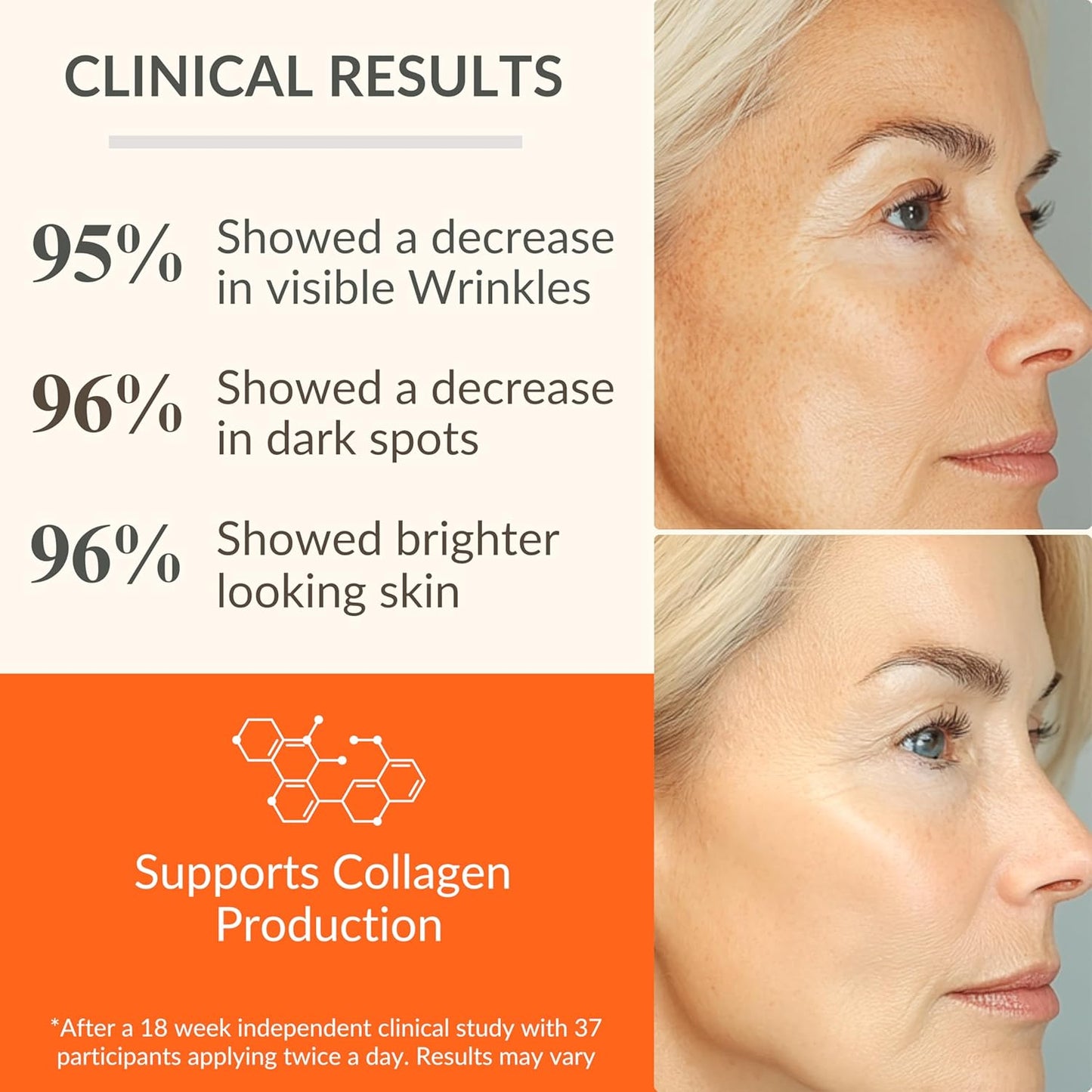 LeVaye Vitamin C Serum, Anti-Aging Face Serum – 15% Vitamin C, Ferulic Acid, Niacinamide, Hyaluronic Acid, Peptides, Ceramides – Targets Wrinkles, Fine Lines, Dark Spots, Enlarged Pores, Dry Skin