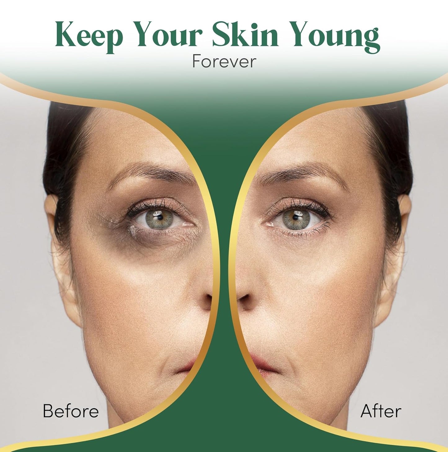 24K Gold Under Eye Patches For Puffy Eyes (36 Pairs Individually Wrapped) - Collagen Enriched Under Eye Masks for Dark Circles and Puffiness, Hyaluronic Acid Under Eye Mask Patches for Wrinkles