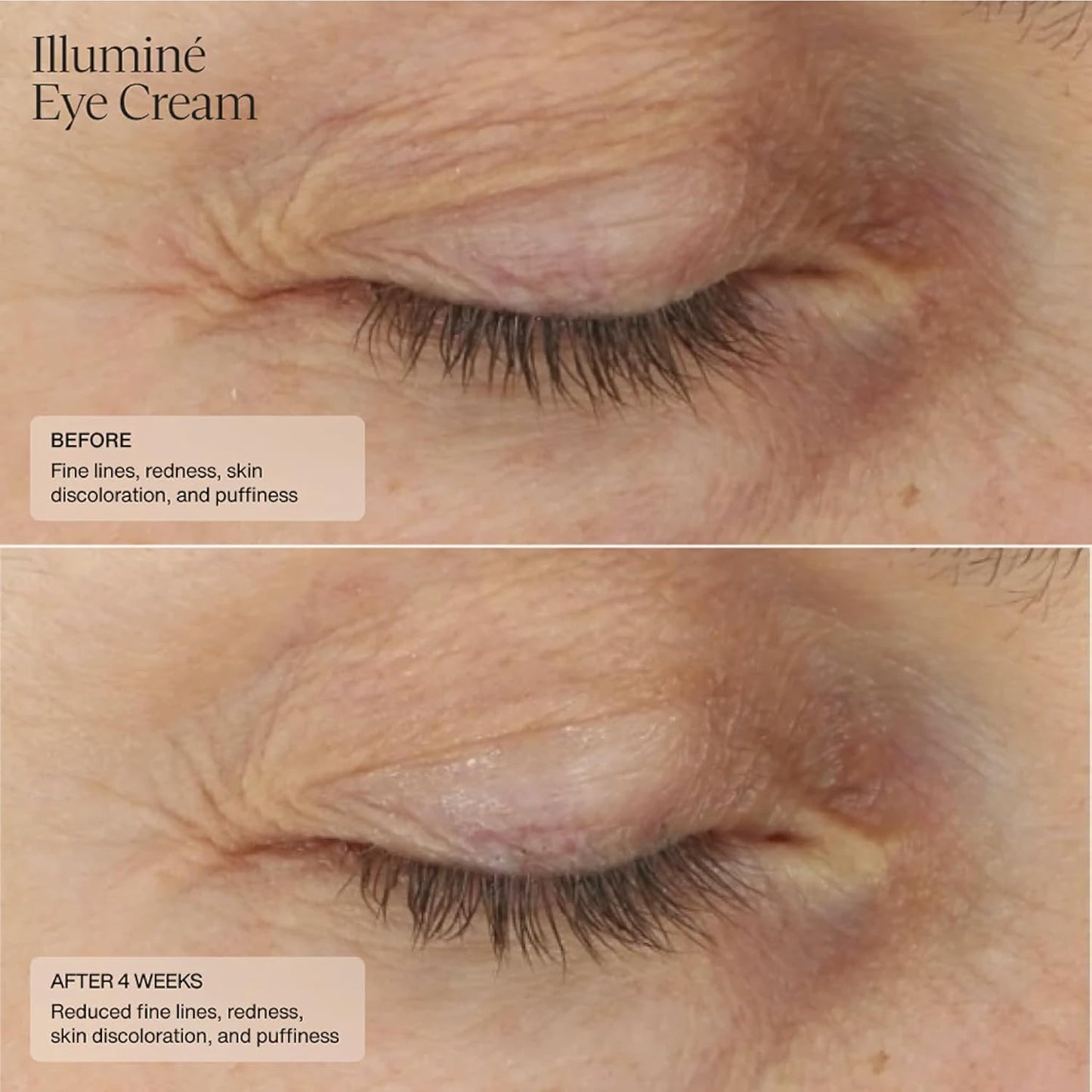 Senté Illuminé Eye Cream | Diminish Dark Circles, Discoloration, Redness, and Puffiness Around The Eyes | with Patented HSA, Niacinamide and Peptides | 0.5 Oz