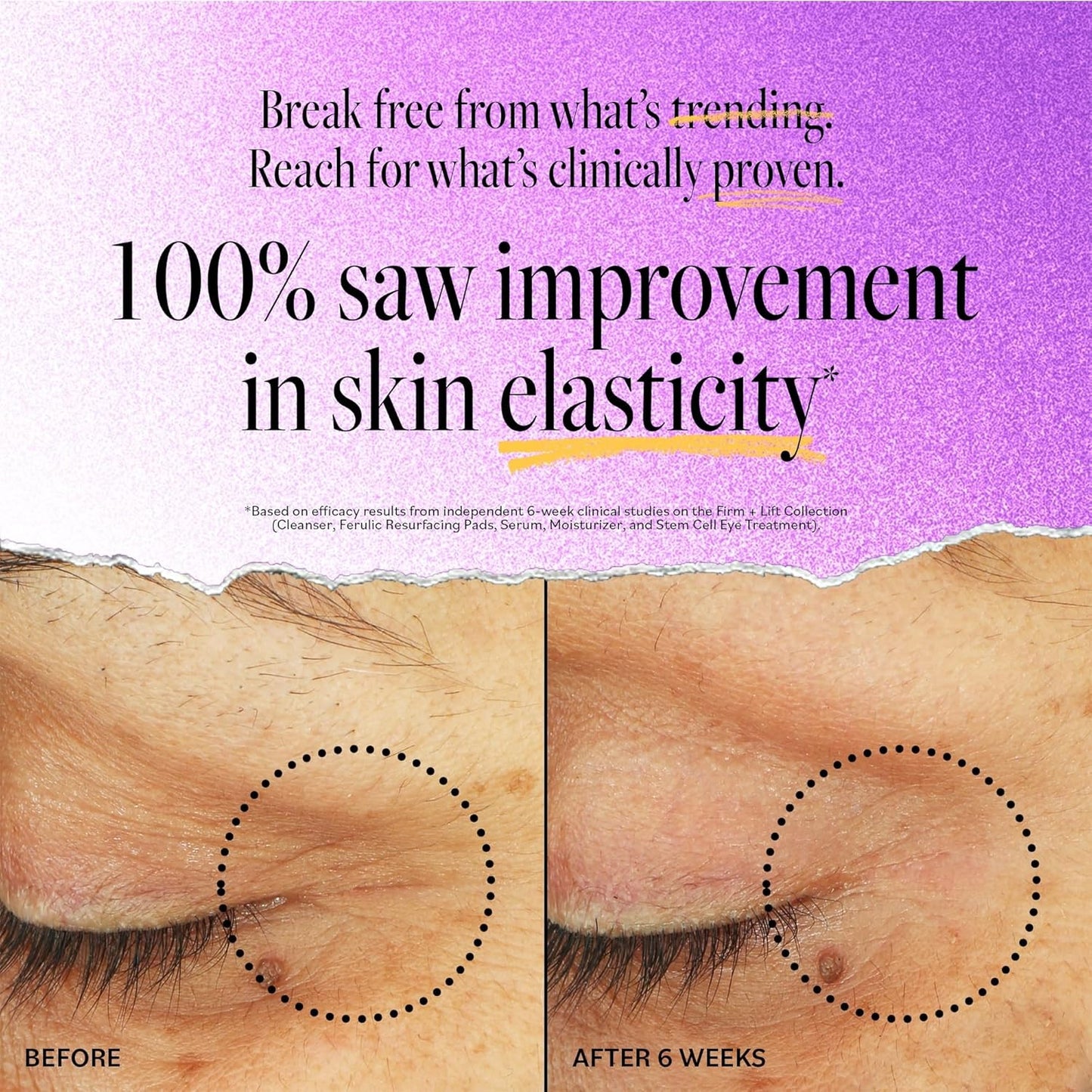 Derma E Stem Cell Lifting Eye Treatment – Multi Action Firming and Tightening Under Eye and Upper Eyelid Cream - Hydrating and Revitalizing Moisturizer, 0.5oz